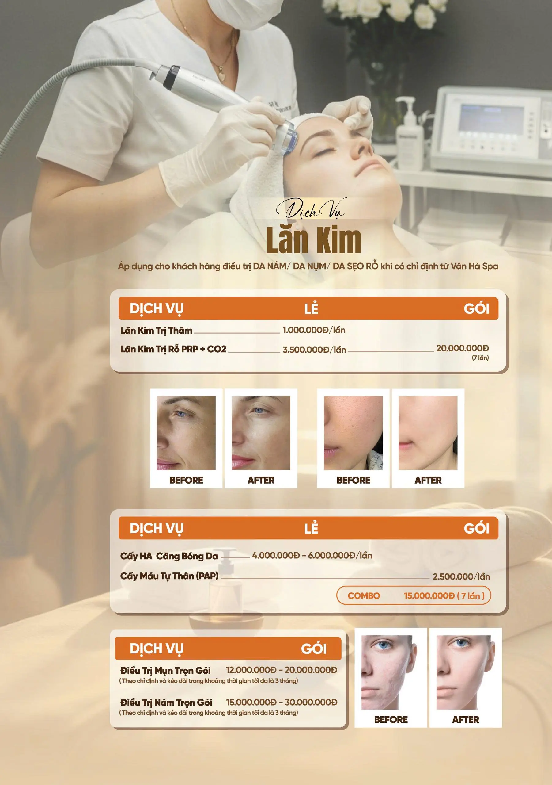 Hệ Thống Dịch Vụ Điều Trị & Trẻ Hóa Da Chuyên Sâu Tại Vân Hà Spa